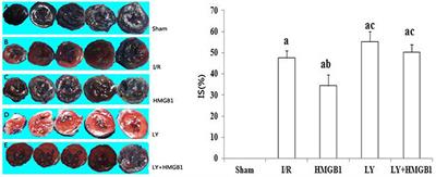 HMGB1 Protects the Heart Against Ischemia–Reperfusion Injury via PI3K/AkT Pathway-Mediated Upregulation of VEGF Expression